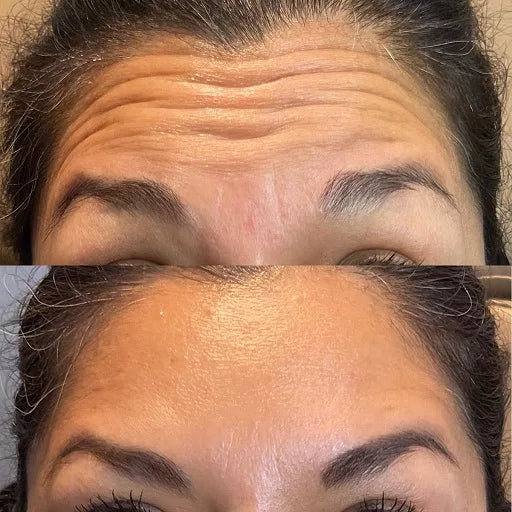 Tox in a bottle - Korean Peptide Toner