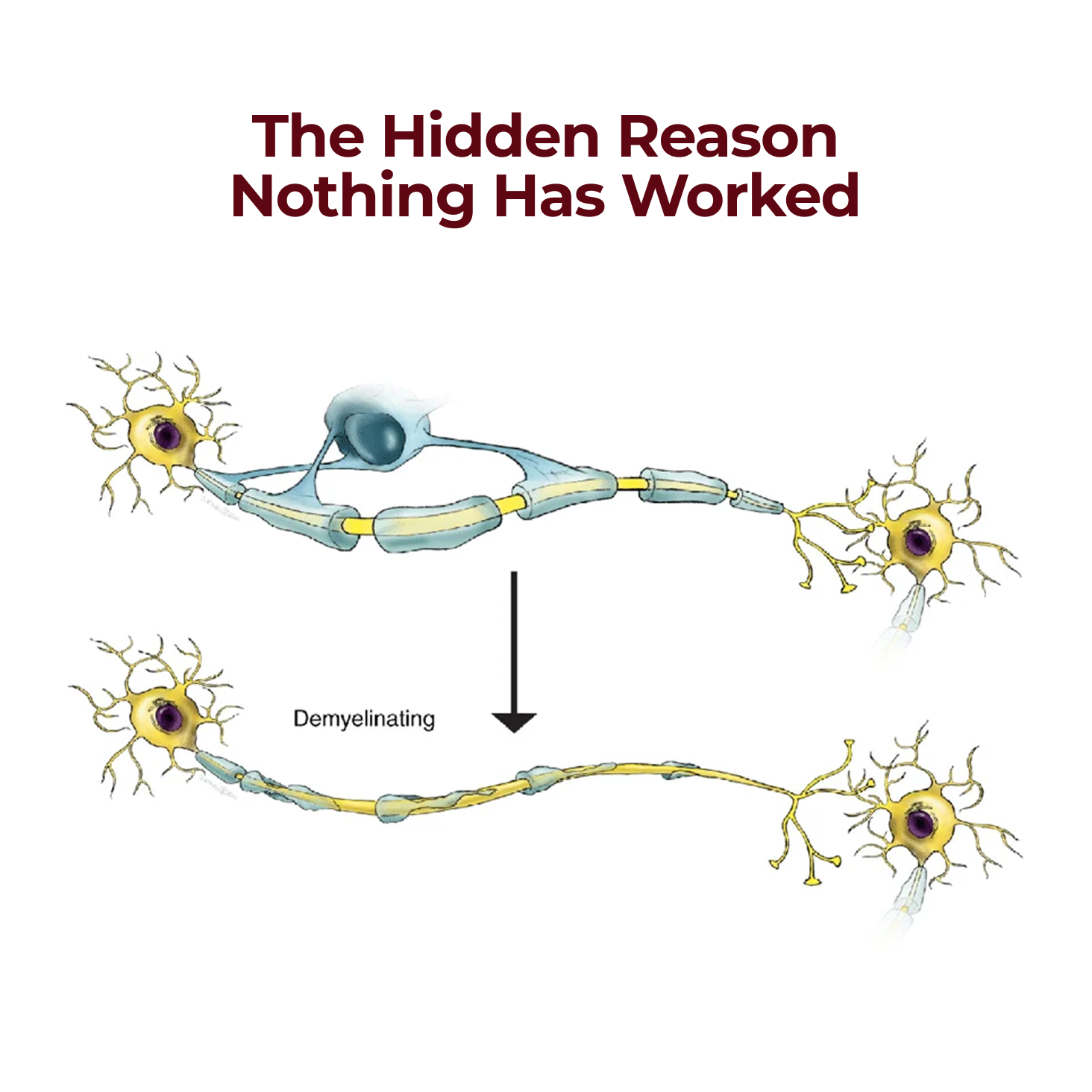 5 in 1 Nerve Protection Complex