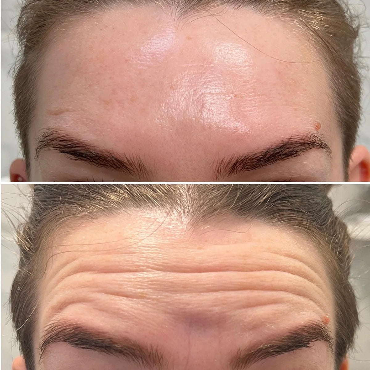 Tox in a bottle - Korean Peptide Toner